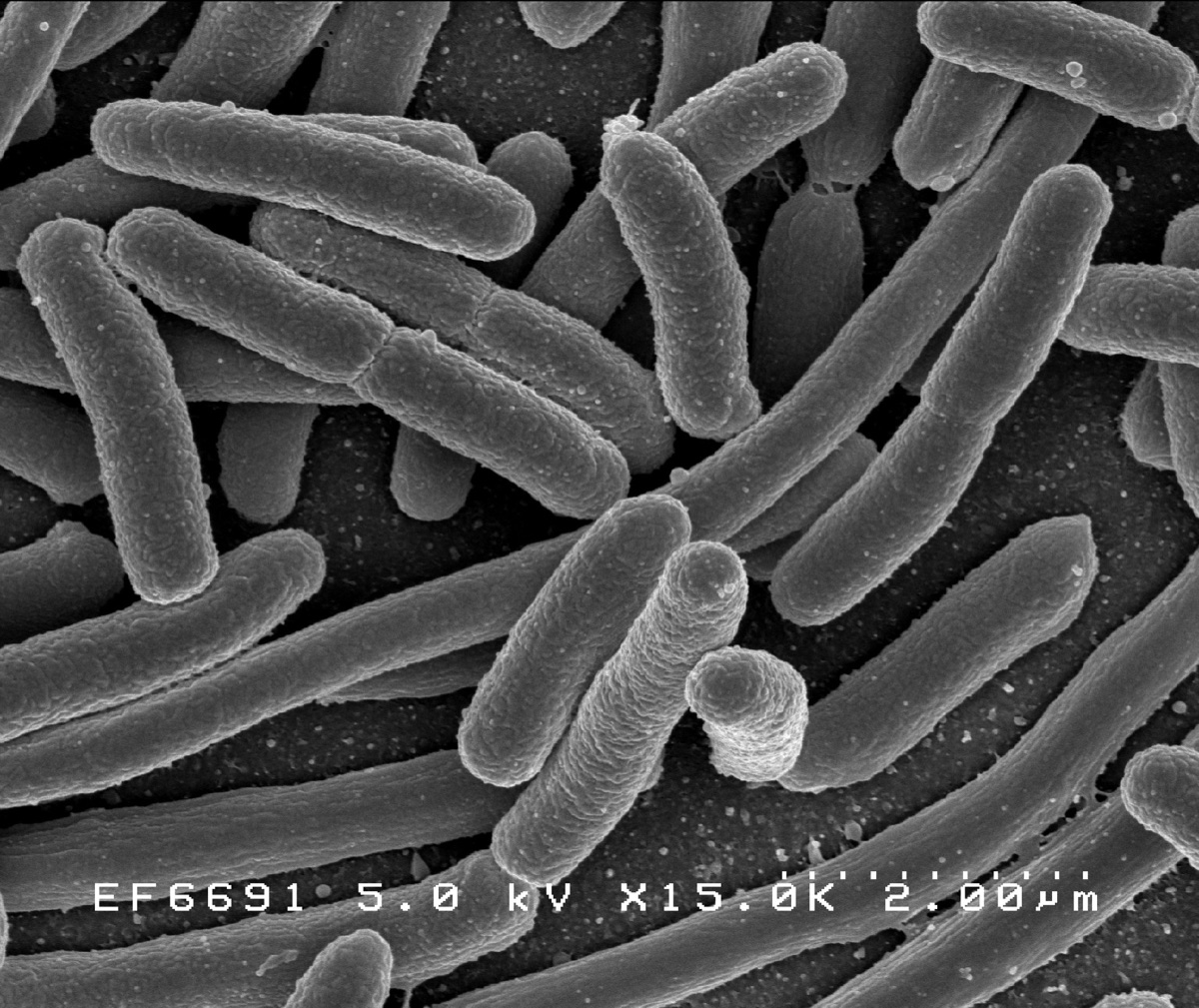 Scanning electron micrograph of Escherichia coli bacteria — rod-shaped cells captured under high magnification