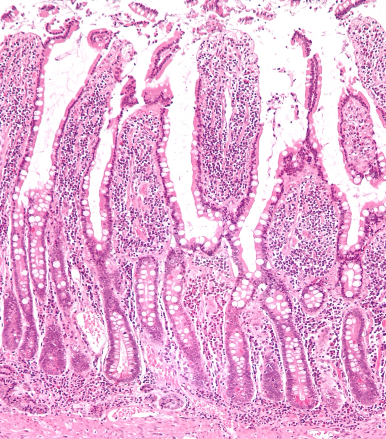 Microscope slide of small intestine (jejunum) showing finger-like villi projecting into the lumen, stained with hematoxylin and eosin